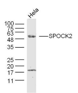 SPOCK2/Testican 2 Rabbit anti-Human, Polyclonal, Bioss 100 &mu;L; Unconjugated:Antibodies,