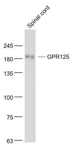 GPR125 Rabbit anti-Human, Polyclonal, Bioss 100 &mu;L; Unconjugated:Antibodies,