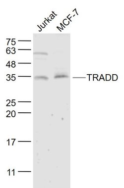 TRADD Rabbit anti-Human, Polyclonal, Bioss 100 &mu;L | Buy Online | Bioss | Fisher Scientific