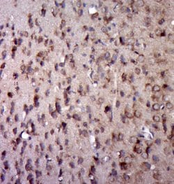 5HT2A Receptor/SR-2A Rabbit anti-Human, Polyclonal, Bioss 100 &mu;L; Unconjugated:Antibodies,