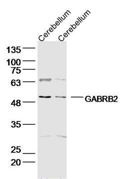 GABRB2/GABA A Receptor beta 2 Rabbit anti-Human, Polyclonal, Bioss 100