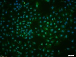 GLI1 Rabbit anti-Human, Polyclonal, Bioss 100 &mu;L; Unconjugated:Antibodies,