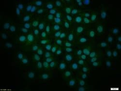GLI1 Rabbit anti-Human, Polyclonal, Bioss 100 &mu;L; Unconjugated:Antibodies,