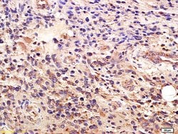 GLI1 Rabbit anti-Human, Polyclonal, Bioss 100 &mu;L; Unconjugated:Antibodies,