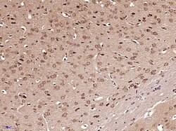 GLI1 Rabbit anti-Human, Polyclonal, Bioss 100 &mu;L; Unconjugated:Antibodies,