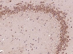 GLI1 Rabbit anti-Human, Polyclonal, Bioss 100 &mu;L; Unconjugated:Antibodies,