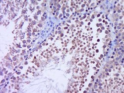 GLI1 Rabbit anti-Human, Polyclonal, Bioss 100 &mu;L; Unconjugated:Antibodies,