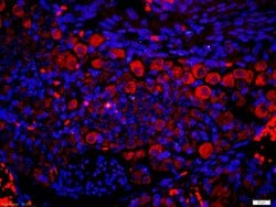 P2Y9 Rabbit anti-Human, Polyclonal, Bioss 100 &mu;L; Unconjugated:Antibodies,