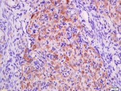 P2Y9 Rabbit anti-Human, Polyclonal, Bioss 100 &mu;L; Unconjugated:Antibodies,