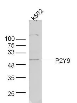 P2Y9 Rabbit anti-Human, Polyclonal, Bioss 100 &mu;L; Unconjugated:Antibodies,