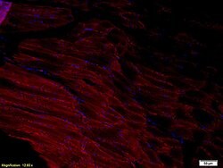 ADAMTS1 Rabbit anti-Human, Polyclonal, Bioss 100 &mu;L; Unconjugated:Antibodies,