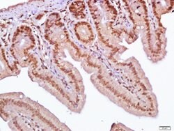SLC38A2/SNAT2 Rabbit anti-Human, Polyclonal, Bioss 100 &mu;L; Unconjugated:Antibodies,