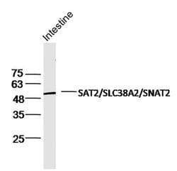 SLC38A2/SNAT2 Rabbit anti-Human, Polyclonal, Bioss 100 &mu;L; Unconjugated:Antibodies,