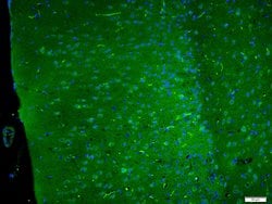 SAPAP4/DLGAP4 Rabbit anti-Human Mouse Rat, Polyclonal, Bioss 100 &mu;L;