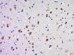 SAPAP4/DLGAP4 Rabbit anti-Human Mouse Rat, Polyclonal, Bioss 100 &mu;L;
