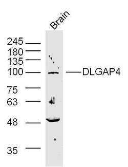 SAPAP4/DLGAP4 Rabbit anti-Human Mouse Rat, Polyclonal, Bioss 100 &mu;L;