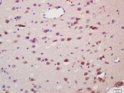 Spinophilin/Neurabin 2 Rabbit anti-Human, Polyclonal, Bioss 100 &mu;L;