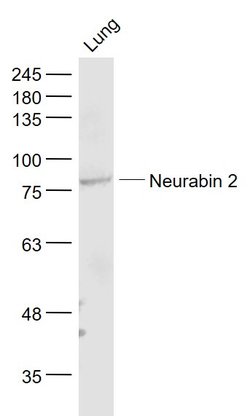 Spinophilin/Neurabin 2 Rabbit anti-Human, Polyclonal, Bioss 100 &mu;L;
