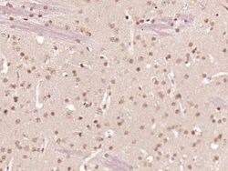 ZNF312 Rabbit anti-Human, Polyclonal, Bioss 100 &mu;L; Unconjugated:Antibodies,