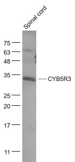 CYB5R3 Rabbit anti-Human, Polyclonal, Bioss 100 &mu;L; Unconjugated:Antibodies,