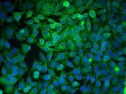 GRP78 Rabbit anti-Human, Polyclonal, Bioss 100 &mu;L; Unconjugated:Antibodies,