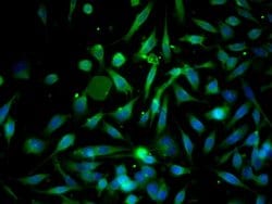 GRP78 Rabbit anti-Human, Polyclonal, Bioss 100 &mu;L; Unconjugated:Antibodies,