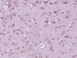 GRP78 Rabbit anti-Human, Polyclonal, Bioss 100 &mu;L; Unconjugated:Antibodies,