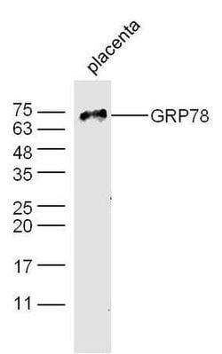 GRP78 Rabbit anti-Human, Polyclonal, Bioss 100 &mu;L; Unconjugated:Antibodies,