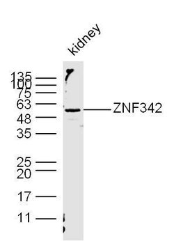 ZNF342/ZNF296 Rabbit anti-Human, Polyclonal, Bioss 100 &mu;L; Unconjugated:Antibodies,
