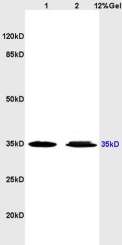 Adenosine A3 Receptor Rabbit anti-Human, Polyclonal, Bioss 100 &mu;L; Unconjugated:Antibodies,