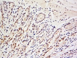 LRRC39 Rabbit anti-Human, Polyclonal, Bioss 100 &mu;L; Unconjugated:Antibodies,