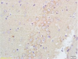 GABA A Receptor alpha 1 Rabbit anti-Human, Polyclonal, Bioss 100 &mu;L;
