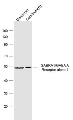 GABA A Receptor alpha 1 Rabbit anti-Human, Polyclonal, Bioss 100 &mu;L;