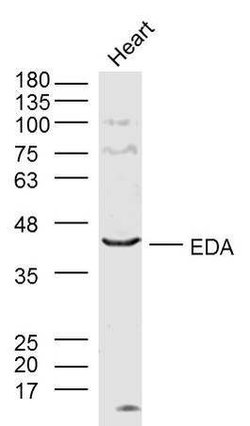 EDA/Ectodermal dysplasia protein Rabbit anti-Human, Polyclonal, Bioss 100