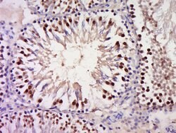 GSC Rabbit anti-Human, Polyclonal, Bioss 100 &mu;L; Unconjugated:Antibodies,