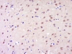 GSC Rabbit anti-Human, Polyclonal, Bioss 100 &mu;L; Unconjugated:Antibodies,