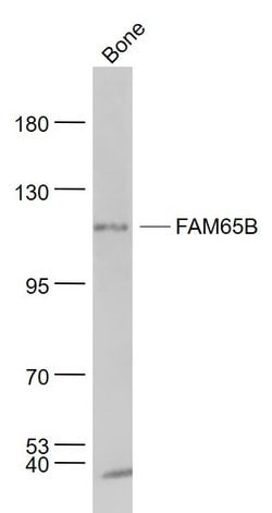 FAM65B Rabbit anti-Human, Polyclonal, Bioss 100 &mu;L; Unconjugated:Antibodies,