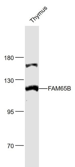 FAM65B Rabbit anti-Human, Polyclonal, Bioss 100 &mu;L; Unconjugated:Antibodies,