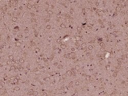 KIF13B Rabbit anti-Human, Polyclonal, Bioss 100 &mu;L; Unconjugated:Antibodies,