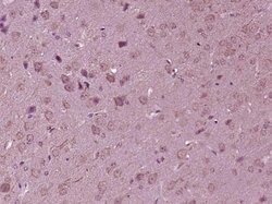 K7 Rabbit anti-Human, Polyclonal, Bioss 100 &mu;L; Unconjugated:Antibodies,
