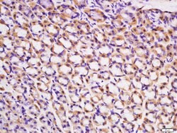ACVR2B/ACTR2B Rabbit anti-Human, Polyclonal, Bioss 100 &mu;L; Unconjugated:Antibodies,