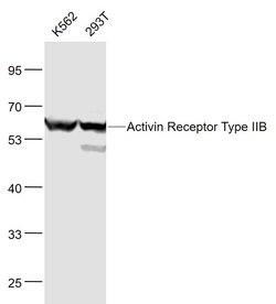 ACVR2B/ACTR2B Rabbit anti-Human, Polyclonal, Bioss 100 &mu;L; Unconjugated:Antibodies,