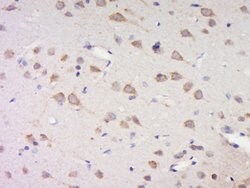 Phospho-Casein kinase 1 isoforms gamma 1/2/3 (Tyr263) Rabbit anti-Human