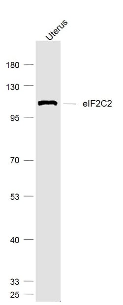 eIF2C2/Ago2 Polyclonal Antibody, Bioss 100 &mu;L; Unconjugated:Antibodies,