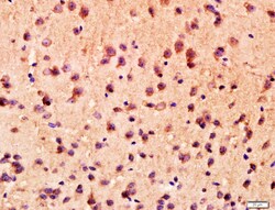 ANKK1 Rabbit anti-Human, Polyclonal, Bioss 100 &mu;L; Unconjugated:Antibodies,