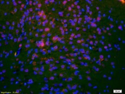 DCLREC1C/Artemis Rabbit anti-Human, Polyclonal, Bioss 100 &mu;L; Unconjugated:Antibodies,