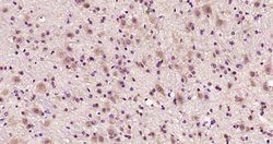 Phospho-Ataxin 1Ser775 (Ser775) Rabbit anti-Human, Polyclonal, Bioss 100