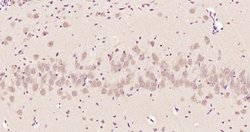 Phospho-Ataxin 1Ser775 (Ser775) Rabbit anti-Human, Polyclonal, Bioss 100