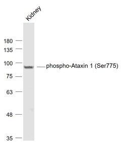 Phospho-Ataxin 1Ser775 (Ser775) Rabbit anti-Human, Polyclonal, Bioss 100