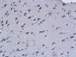 FGF3 Rabbit anti-Human, Polyclonal, Bioss 100 &mu;L; Unconjugated:Antibodies,